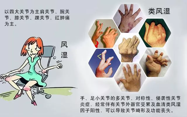 这些病症你中了几项?超过4项患类风湿性关节炎的几率极高