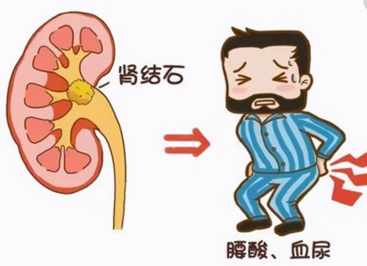 吃素到底好不好?素食者容易缺乏这5种营养素?该怎么补?
