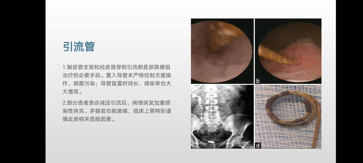 小病要人命!