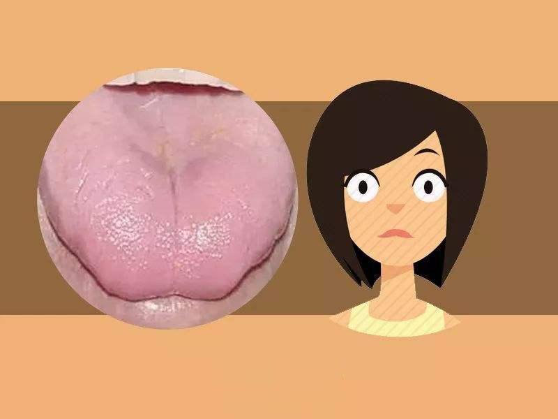 看舌头,知全身?自己是什么体质,体内是否有疾,伸舌一看便知